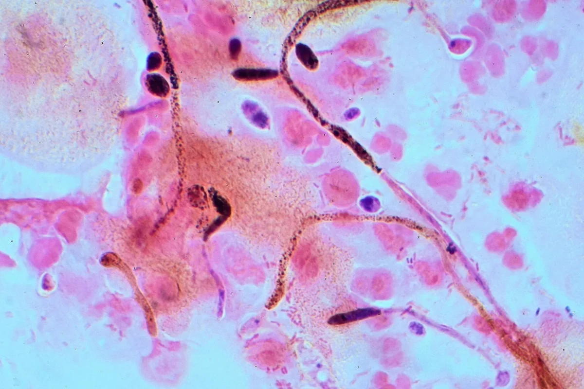 Candida mantarının mikroskop altındaki görünümü